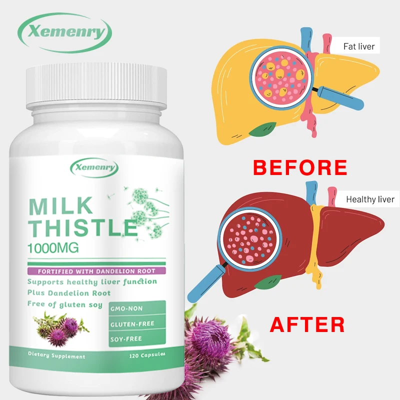 밀크시슬 캡슐 1000mg - 민들레 뿌리 함유 - 간 - Milk Thistle Silymarin 리뷰 및 가격